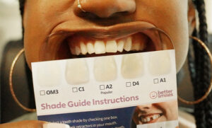 BetterSmiles - Teeth with Shade Guide